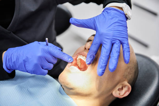 Best Emergency Tooth Extraction  in Batavia, IL